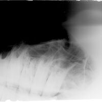 Röntgenbild Backenzähne und Stirnhöhlen